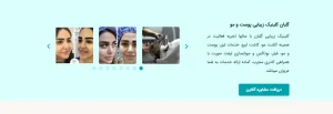لیست 10 تا از بهترین کلینیک‌ زیبایی در شهرک غرب : کلینیک زیبایی گلبان