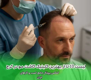 لیست 10 تا از بهترین کلینیک کاشت مو در کرج